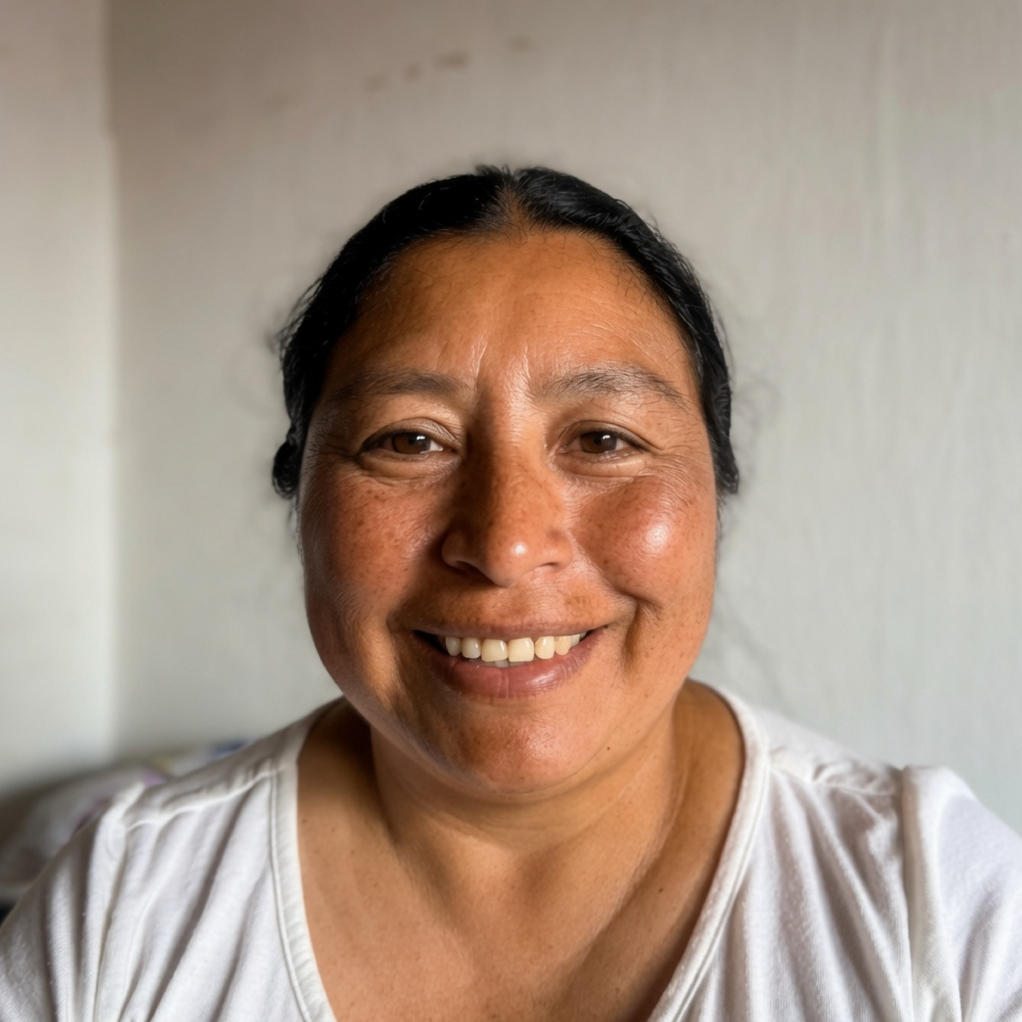 Paciente atendido por várices